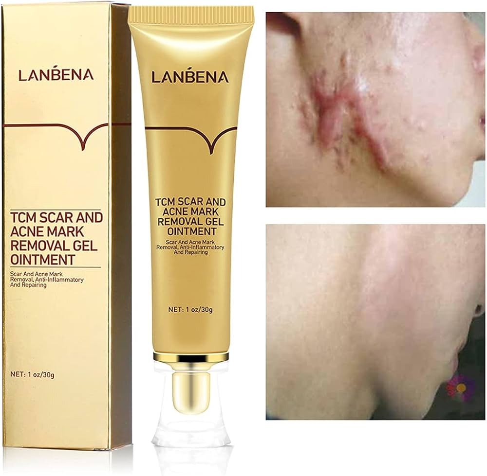 Lanbena TCM scar removal cream (Update version) Original